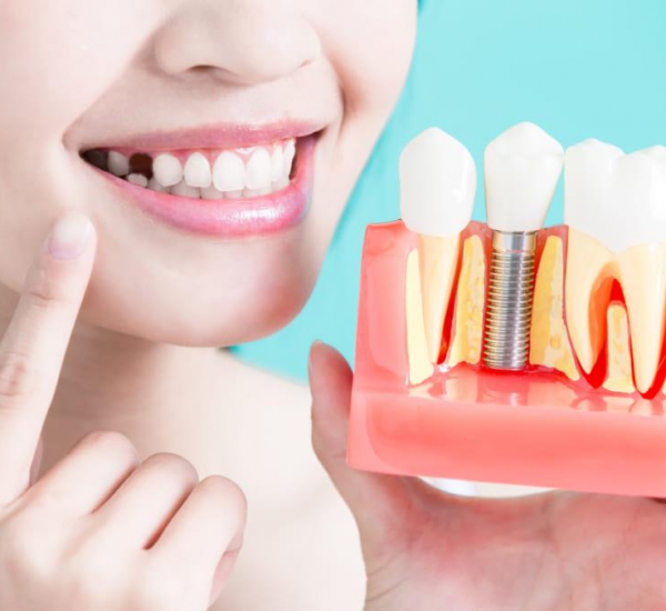 Trồng Răng Implant Uy Tín Tại Đà Nẵng - Ưu Đãi 30% - Tặng Răng Sứ Cao Cấp