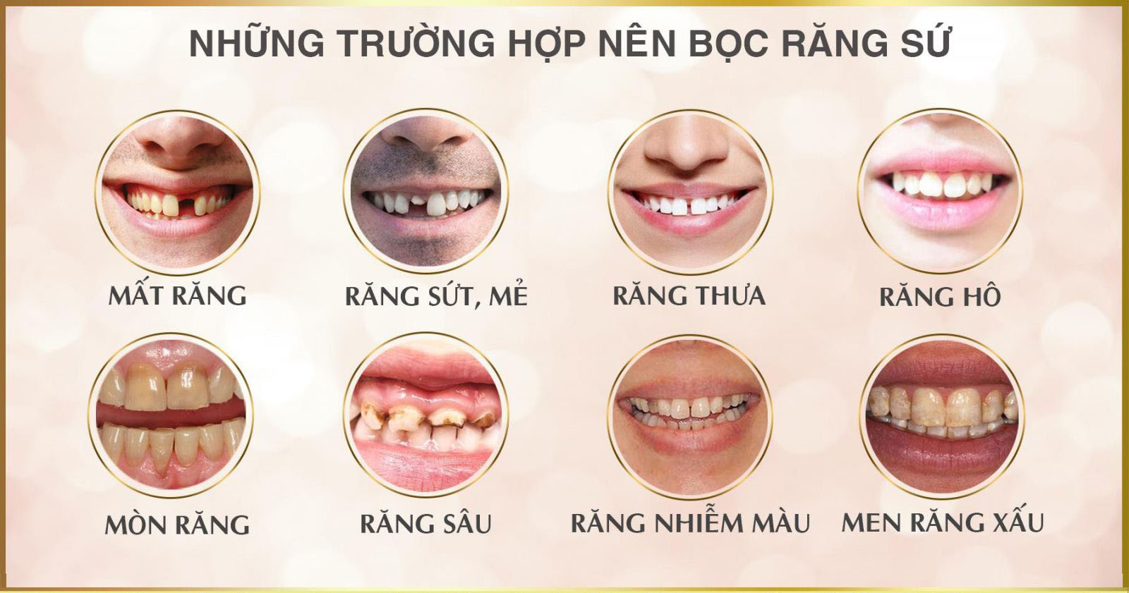 NHA KHOA SÀI GÒN QUỐC TẾ ĐÀ NẴNG