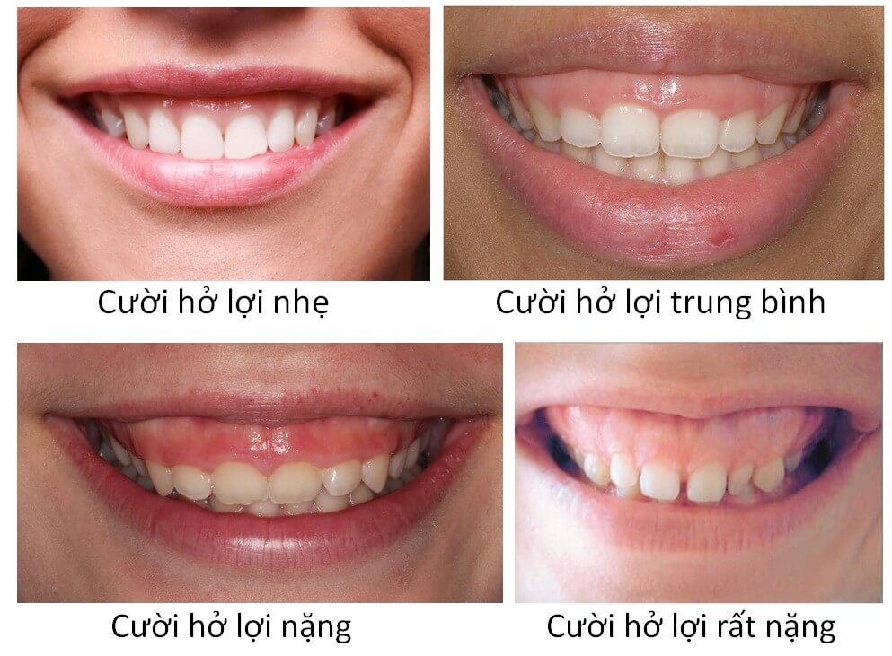 NHA KHOA SÀI GÒN QUỐC TẾ ĐÀ NẴNG