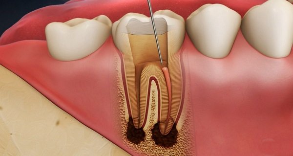 Hệ thống nha khoa sài gòn quốc tế