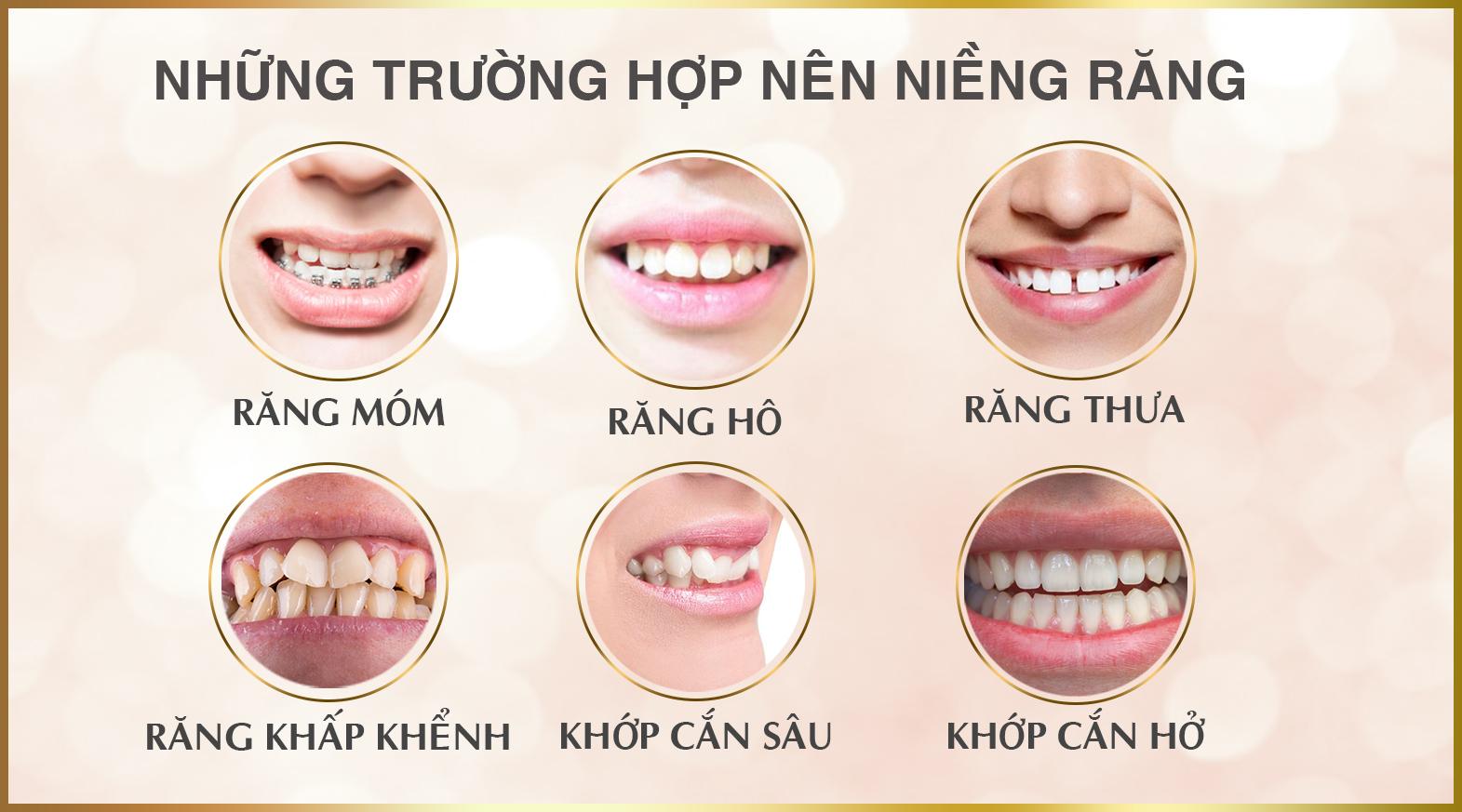 NHA KHOA SÀI GÒN QUỐC TẾ ĐÀ NẴNG