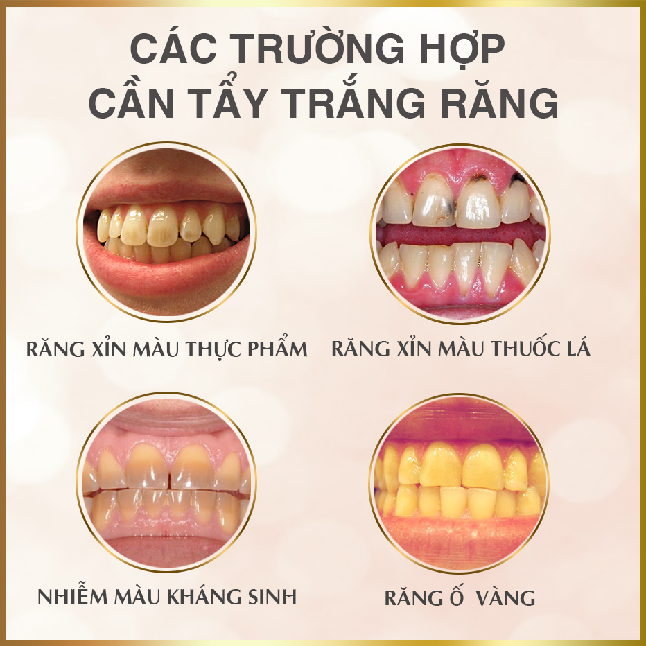 NHA KHOA SÀI GÒN QUỐC TẾ ĐÀ NẴNG