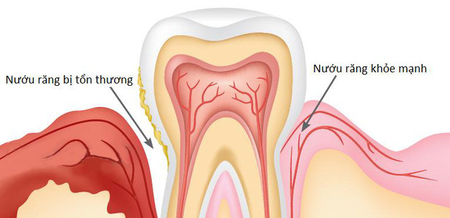 NHA KHOA SÀI GÒN QUỐC TẾ ĐÀ NẴNG 